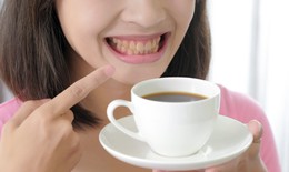 5 cách uống cà phê không lo răng bị ố vàng