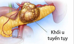Các phương pháp điều trị u đầu tụy