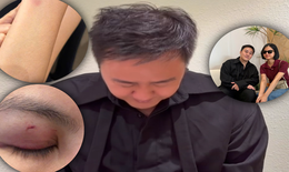 Trung Quân Idol đăng video xin lỗi vợ chồng bác sĩ Phạm Minh Trường