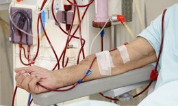 Nhiều bệnh nhân hồi sức nguy cơ suy thận, lọc máu liên tục cần làm sớm, không chờ 'giai đoạn muộn'