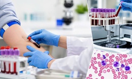 Những xét nghiệm cơ bản ai cũng nên làm