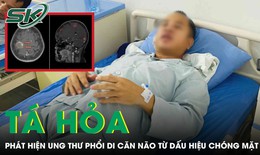 Người đàn ông tá hỏa phát hiện ung thư phổi di căn não từ dấu hiệu chóng mặt