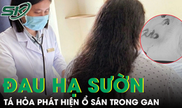 Phát hiện ổ sán làm tổ trong gan từ dấu hiệu đau hạ sườn phải kéo dài 