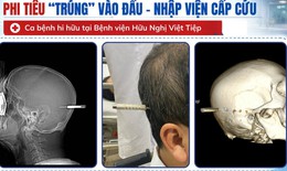 Người đàn ông bị phi tiêu cắm trúng đầu nhập viện khẩn cấp
