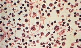 Tỷ lệ tử vong do nhiễm virus Hanta tăng cao, Chile nâng mức cảnh báo y tế