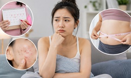 Dấu hiệu buồng trứng đa nang dễ bị bỏ qua