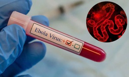 TPHCM tăng cường giám sát trước nguy cơ dịch Ebola xâm nhập