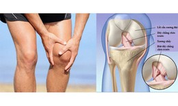 Đau khớp gối khi leo cầu thang có đáng lo?
