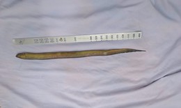 Đau bụng dữ dội, bác sĩ phát hiện con lươn dài hơn 50cm trong
ổ bụng người đàn ông