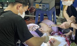 Vụ ông Nguyễn Tiến Nam: Bác sĩ nói gì về việc tự ý mổ u bằng dao điện cao tần?