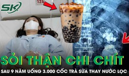 Uống 3.000 cốc trà sữa thay nước lọc suốt 9 năm, thận cô gái mọc chi chít sỏi