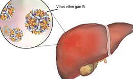 Viêm gan B có lây qua ăn uống, ôm hôn không và cách phòng tránh