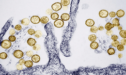 WHO đánh giá nguy cơ lây lan virus Hanta trong cộng đồng ở ‘mức thấp’