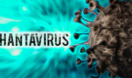 Bộ Y tế lên tiếng về virus Hanta sau chùm ca tử vong trên tàu du lịch nước ngoài