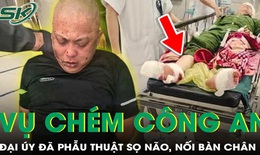 Đại úy công an bị chém tại trụ sở đã được nối lại bàn chân và phẫu thuật sọ não
