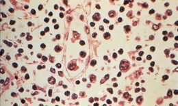 Đài Loan (Trung Quốc) ghi nhận 1 ca tử vong do nhiễm virus Hanta