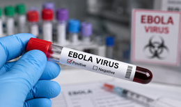 Bác sĩ Bạch Mai chỉ ra quy tắc '2 - 5 - 30' trong ngăn chặn Ebola