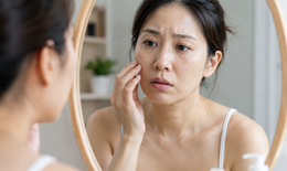 Da chảy xệ sau giảm cân, có nên bổ sung collagen?