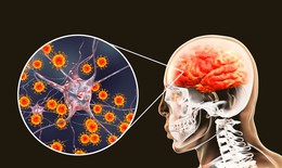 Hà Nội ghi nhận ca viêm não Nhật Bản, bác sĩ khuyến cáo cách phòng bệnh hiệu quả