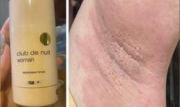 Nổi mề đay, đau nhức vùng nách rồi lan khắp cơ thể sau khi dùng lăn khử mùi 'hàng Nhật' xách tay