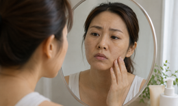 Thiếu magie biểu hiện trên làn da như thế nào?