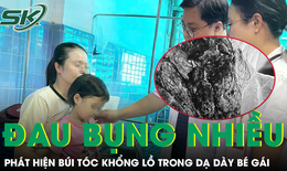 Đau bụng nhiều ngày, bé gái 4 tuổi bất ngờ được bác sĩ lấy ra khỏi dạ dày búi tóc khổng lồ