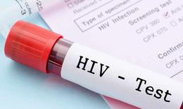5 dấu hiệu cảnh báo nhiễm HIV nhiều người nhầm với bệnh thông thường