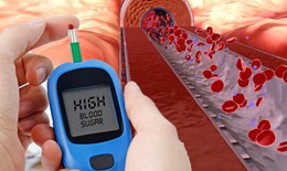 8 cách đơn giản giúp bảo vệ thận khỏe mạnh mỗi ngày