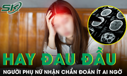 Đau đầu dai dẳng không rõ nguyên nhân, người phụ nữ nhận chẩn đoán ít ai ngờ