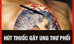 WHO: Cảnh báo trên bao bì thuốc lá là cách truyền thông hiệu quả, ít tốn kém