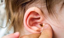 Dấu hiệu nhọt ống tai ngoài ở trẻ và cách xử trí đúng