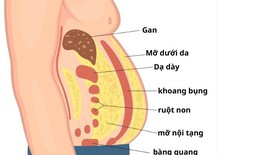 Mỡ nội tạng nguy hiểm hơn mỡ dưới da như thế nào?