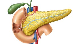 Tăng mỡ máu có thể gây viêm tụy cấp nguy hiểm đến tính mạng