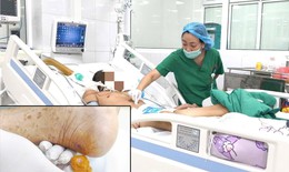 Gà mổ vào gót chân khiến cụ ông nguy kịch