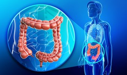 Ai có nguy cơ cao mắc ung thư đại trực tràng?