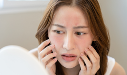 Qua rồi những ngày nắng gắt, làn da đã thực sự được 'nghỉ'?