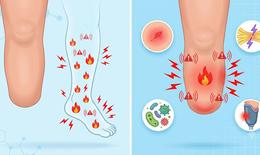 Thời tiết thay đổi có thể khiến tay chân đã cụt bị đau trở lại