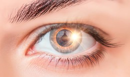 Cô gái suốt đời thấy hình lưỡi liềm trong mắt chỉ sau vài giây xem nhật thực