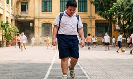 Những rủi ro về sức khỏe khi trẻ thừa cân, béo phì