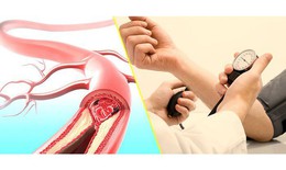 Có phải cứ chóng mặt là do cao huyết áp?