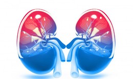 Viêm cầu thận: Nhận biết sớm để tránh biến chứng