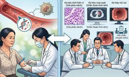 Xét nghiệm ctDNA có quyết định việc hóa trị sau mổ ung thư đại tràng?