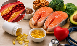 Người bị mỡ máu cao có nên uống omega-3 mỗi ngày?