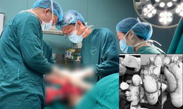 Suýt mất 2 bàn chân vì tự chườm nóng tại nhà khi bị tê bì