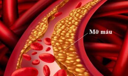 Mỡ máu cao âm thầm hại tim
