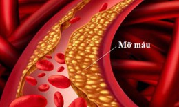 Làm thế nào để biết mình đang bị máu nhiễm mỡ?