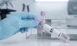 Xét nghiệm STI là gì và khi nào nên xét nghiệm?