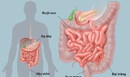 5 sai lầm khi chăm sóc người cao tuổi bị khó tiêu kéo dài