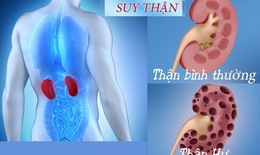 Đề phòng chứng an thần kinh ác tính do thuốc an thần