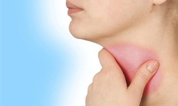 Cách phòng ngừa viêm họng